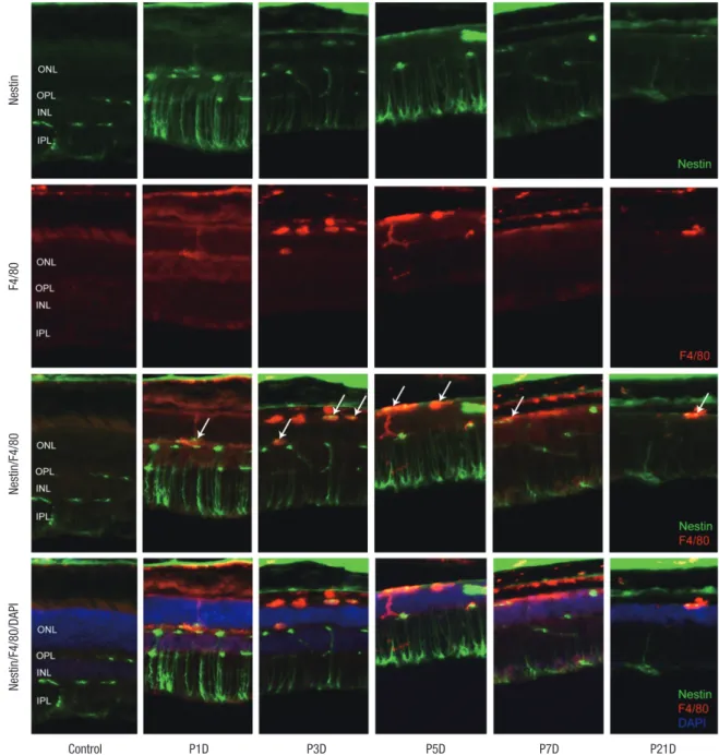 Fig. 3. Nestin and F4/80 expression in control and degenerated adult mouse retina. Immunofluorescent labeling with nestin (green), F4/80 (red), and DAPI (blue) is shown