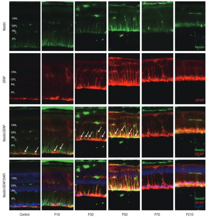 Fig. 4. Nestin and GFAP expression in control and degenerated adult mouse retina. Immunofluorescent labeling with nestin (green), GFAP (red), and DAPI (blue) is shown