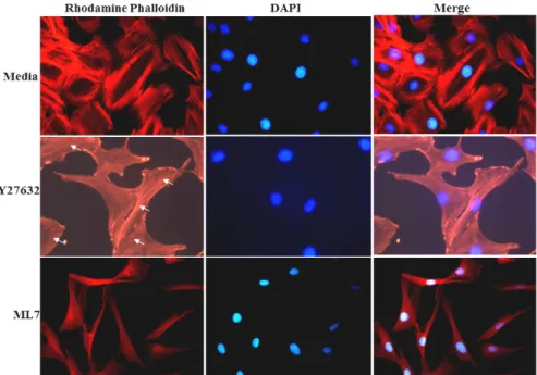 Fig.  4.  Roles  of  MLCK  and  ROCK  on  SF  alignment  in  FRCs.  Representative  images  of  FRCs  adhered  on  slide  chamber  subjected  for  1  hr  after  treatment  with  5  μM  ML7  or  10  μM  Y27632
