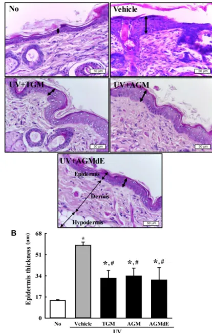 Fig.  4.  Histopathological  structure  of  skin  sam- sam-ples  from  hairless  mice  following  topical  application  of  AGM  and  AGMdE  and  analysis  of  UV-irradiated  skin   inflamma-tion  in  the  hairless  mice