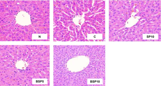Fig.  5.  Effects  of  SP,  BSP5  and  BSP10  on  the  hepatic  histopathologic  changes  in  orotic  acid  feeding  rats
