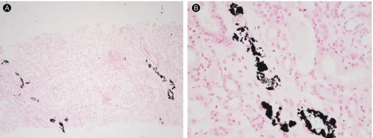 Figure 2. Black staining indicates that these deposits correspond to calcification (deposits represent calcium phosphate) (× 100 [A], × 400 [B]).