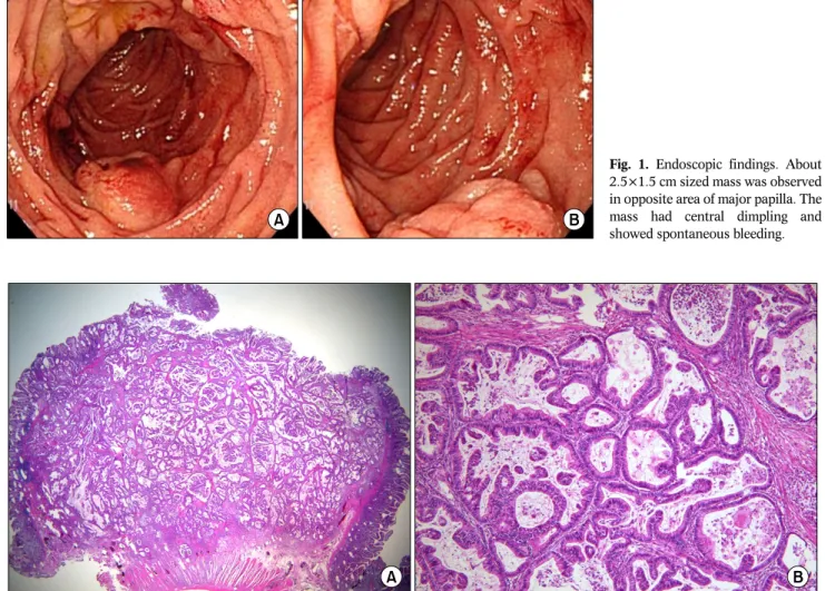 Fig. 1. Endoscopic findings. About 
