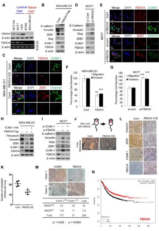 Figure 3: FBXO4 regulates EMT and metastasis in breast cancer.  (A) Expression of the FBXO4 gene between the luminal  (metastatic) and basal subtypes (non-metastatic) of breast cancer was detected by conventional RT-PCR