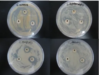 Table  2.  Antimicrobial  activity  of  70%  ethanol  extract  from  different  parts  and  essential  oil  of  Pinus  densiflora 
