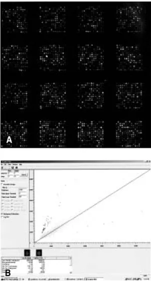 Fig. 1. A: Cy3 (green) and Cy5 (red) images of a sub-grid of M2500 slides after self-against-self hybridization were overlaid to show relative expression of each spots in both channels, B: DNA labeled targets were hybridized to M2500 slides, containing 3,0