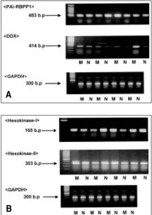 Fig. 2. A: RT-PCR analysis of PAI-RBP1, DDX1 and GAPDH mRNA expression in leiomyomas and normal myometrial tissues, B: RT-PCR analysis of Hexokinase 1, 2 and GAPDH mRNA expression in leiomyomas and normal myometrial tissues
