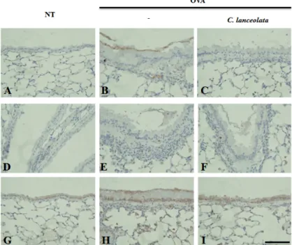 Fig.  4.  Immunohistochemical  analyses  of  C.  lanceola- lanceola-ta  extract  treated  lung  tissues  in  ovalbumin  (OVA)-challenged  mice