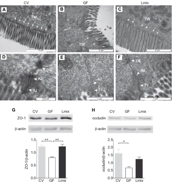 Fig.  2.  The  effects  of  Lmix  colonization  on  the  architecture  of  the  apical  junctional  complex  of  enterocytes  and  the  production  of  ZO-1  and  occludin