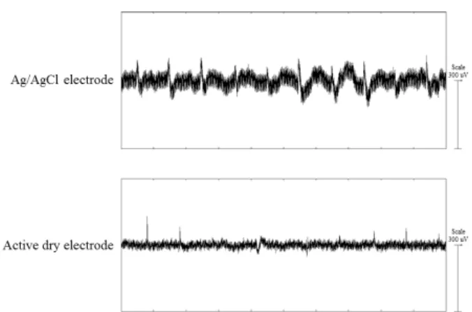 Figure 5. Pop artifact and 60 Hz noise acquired without  a notch filter.