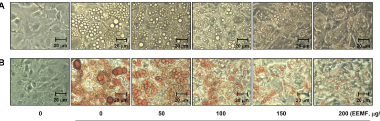 Fig.  2. Effects  of  EEMF  on  the  microscopic  morphological  changes  and  lipid  droplet  accumulation  of  differentiated  3T3-L1  mouse  preadipocytes