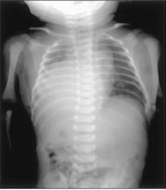 Fig. 2. Thoracic and abdominal MRI finding (A:
