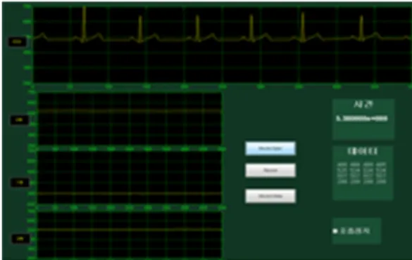 Fig. 2. An electrocardiogram with the x, y, and z-axes  represented in graphical user interface graphs