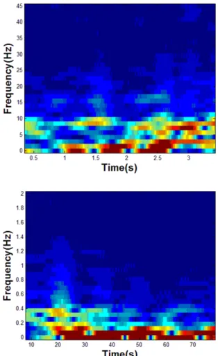 Fig. 3. Oscillation of LF/HF in breathing state and  apnea state by time frame. 