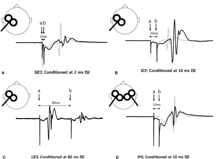 Figure 6. Paired-pulse TMS. ISI is demonstrated as interval from conditioning stimulation (a) to test stimulation (b)