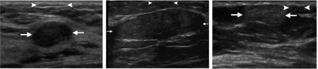 Fig. 6. Examples of (a) hypoechoic; (b) isoechoic, and (c) hyperechoic patterns in ultrasonography