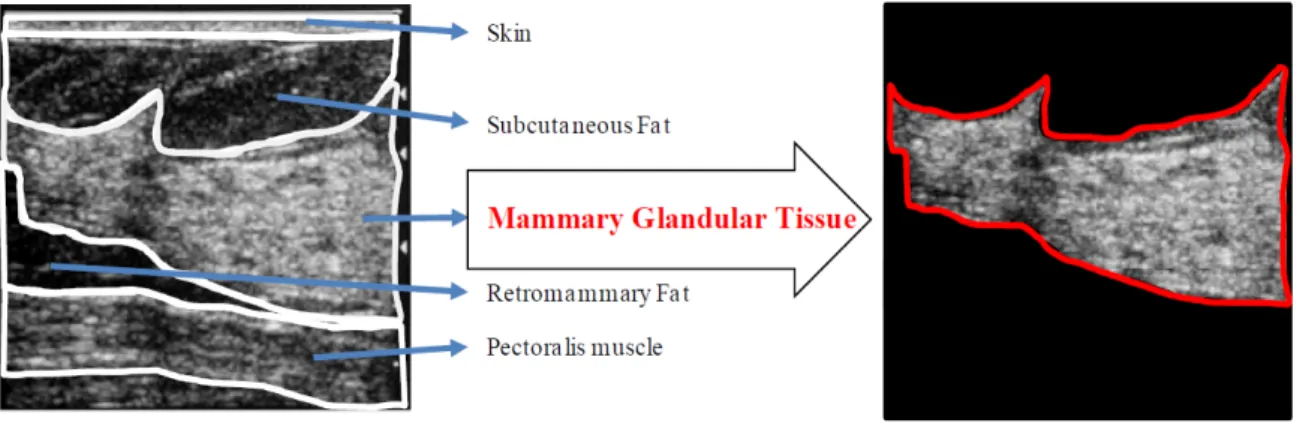 Fig. 8. Example of morphological information in breast ultrasonography and the area of mammary glandular   tissue separated from the image