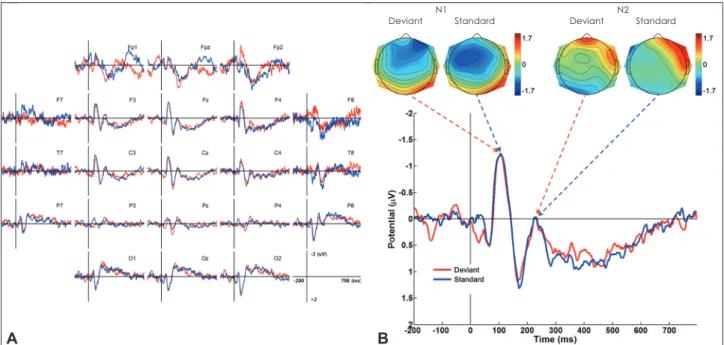Fig. 2. A: Grand averages showing N1 and N2 components evoked by a standard and a deviant stimulus in the control paradigm