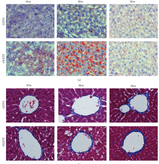 Figure 3: Liver histology. Representative images of Oil Red O (a) and Masson’s trichrome (MT) staining (b) of the livers at 10, 30, and 50 weeks of age (magnification, ×400).
