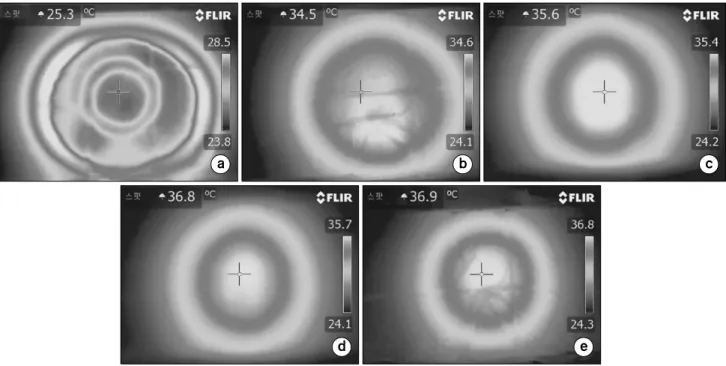 Fig.  6.  Thermal  distribution  of  25-15  cm  electrode  (liver  protocol  session5),  (a)  surface,  (b)  depth  3  cm,  (c)  depth  6  cm,  (d)  depth  9  cm,  (e)  depth  12  cm