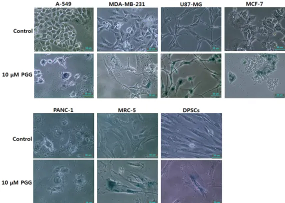 Fig.  3.  Changes  of  cell  morphology  and  senescence-associated-β-galactosidase  activity  in  A-549,  MDA-MB-231,  U87-MG,  MCF-7,  PANC-1,  MRC-5  and  DPSCs  cell  lines  treated  with  10  μM  PGG  for  7  days  (×200)
