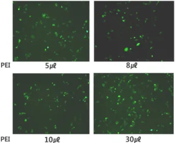 Fig.  1.  Optimization  of  transfection  conditions.  HeLa  cells  were  cultured  in  a  12-well  plate  (5×10 4   cells/well)