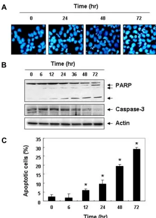 Fig.  4.  Induction  of  apoptosis  by  5-FU  in  CHP-100  cells.  Cells  were  treated  with  50  μM  5-FU  for  the  time  indicated