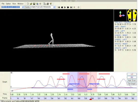 Figure 1. Computerized gait analysis system using reflective foot marker.불편을 주는 증상의 하나이다.1 파킨슨씨병 환자의 보행은 보폭이 좁고 속도가 느리며 걷는 중에 발을 끌고 보행 중 앞으로 쓰러질 듯 속도가 빨라지는 가속 양상을 보인다.2이러한 파킨슨씨병의 보행에 관해 시행된 연구 결과, 보속은 정상이나 활보장과 보행속도는 감소되고 관절가동범위가 감소됨이 보고되었다