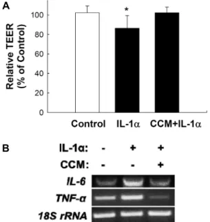 Fig.  3.  Preventive  effect  of  curcumin  on  IL-1α-induced  drop  in  transepithelial  resistance  (TEER)  of  Caco-2  cells