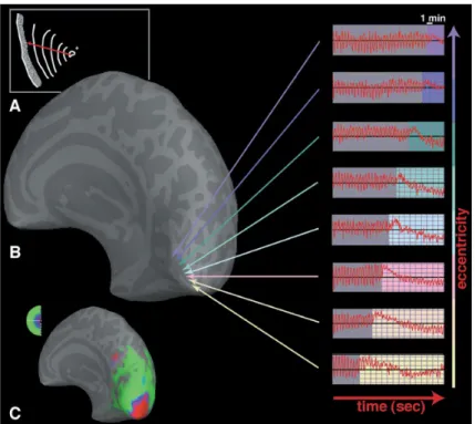 Figure 2. Spreading suppression of cor- cor-tical activation during migraine aura. (A)  A drawing showing the progression over  20 min of the scintillations and the  visual field defect affecting the left  hemifield, as described by the patient  (P.R.)