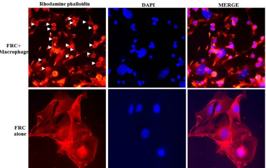Fig.  1.  Alteration  of  cell  morphology  of  FRC  through  a  fluorescence  microscopy