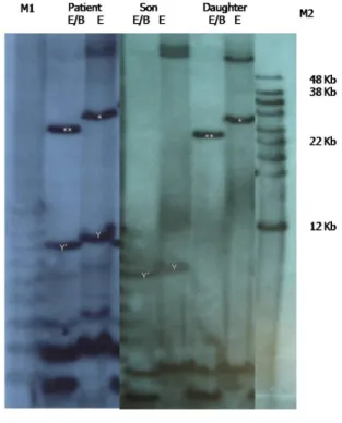 Figure 3. Southern blot analysis result. Convential  electrophoresis and Southern blot analysis of  EcoRI (E) and EcoRI/BlnI (E/B) digested DNA  from the patient and daughter revealed a 28-kb  sized  EcoRI fragment (*), which is reduced to  25-kb fragment 