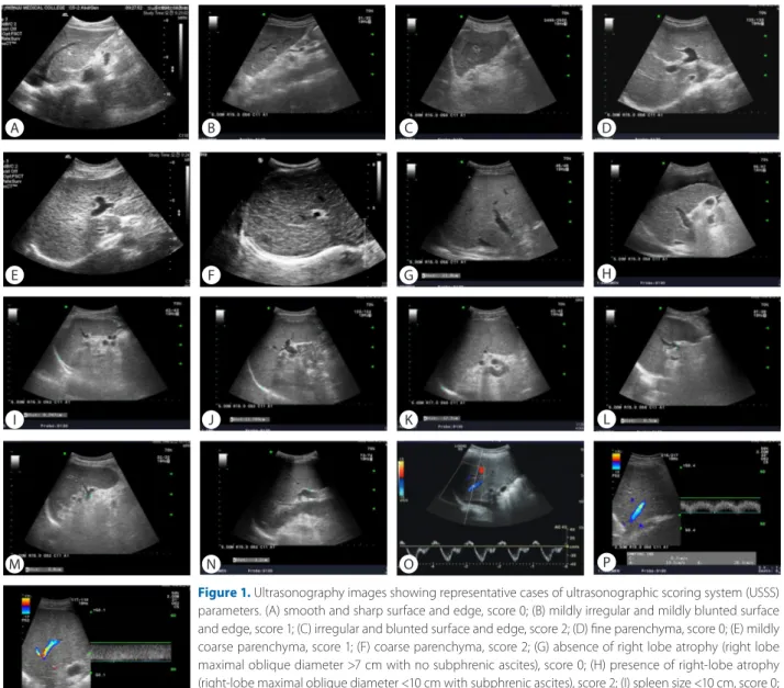 Figure 1. Ultrasonography images showing representative cases of ultrasonographic scoring system (USSS)  parameters