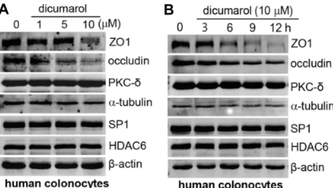 Fig.  3.  Dicumarol-treatment  reduces  the  expression  of  tight  junc- junc-tion  proteins  in  HT29  cells
