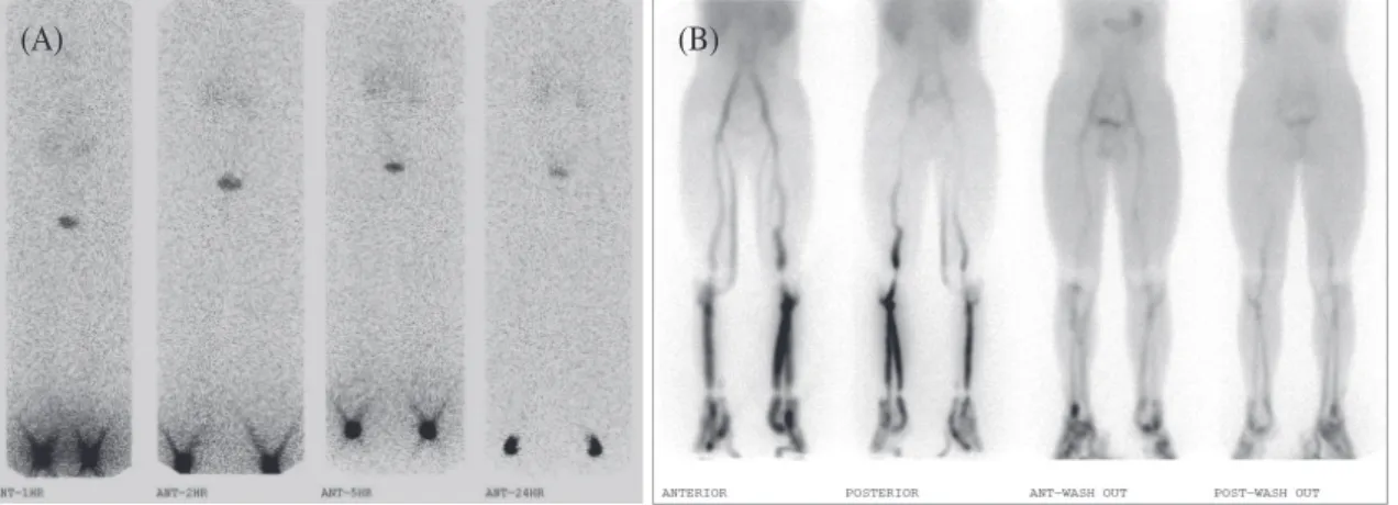 Fig. 2. 18-y-o male referred from both feet swelling after prolonged standing or prolonged sitting