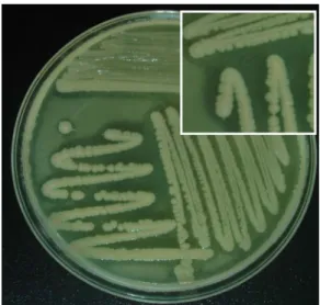 Fig.  1.  Lipase  activity  from  Pseudomonas  sp.  BCNU  106.  BCNU  106  is  grown  on  LB  agar  medium  supplemented  with  1%  tributyrin  and  1%  tween  80  at  37℃ for  72  hr