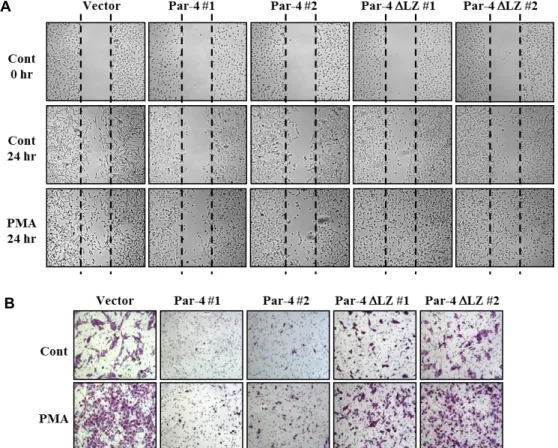 Fig.  2.  Effect  of  Par-4  on  PMA-induced  Caki  cell  migration  and  invasion.  (A)  Confluent  monolayer  of  Caki  cells  was  wounded  and  images  were  taken  immediately  (control-0  hr)