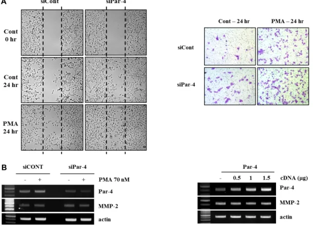 Fig.  4.  Effect  of  knock-dwon  of  Par-4  protein  on  PMA-induced  cell  migration  and  invasion