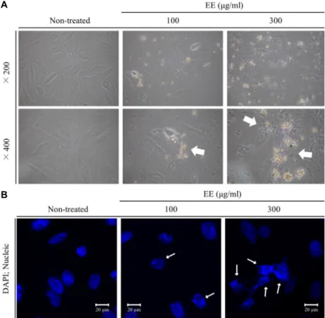 Fig.  2.  The  extracts  from  E.  cottonii  induced  morphological  changes  in  Saos-2  cells