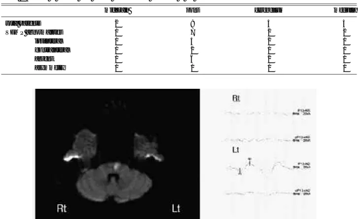 Figure 1. Example of VEMP abnormality in infratentorial stroke patients. The Diffusion weighted image shows acute ischemic infarction in left pons (left) and no potentials was observed in right side of VEMP recording (right).