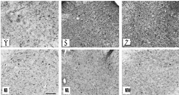 Figure 4. Effects of multi-vitamin treatment in G93A SOD1 transgenic mice. Immunostaining was performed in the spinal cords of G93A transgenic mice and wild-type mice (non-transgenic littermate) at 120 days of age
