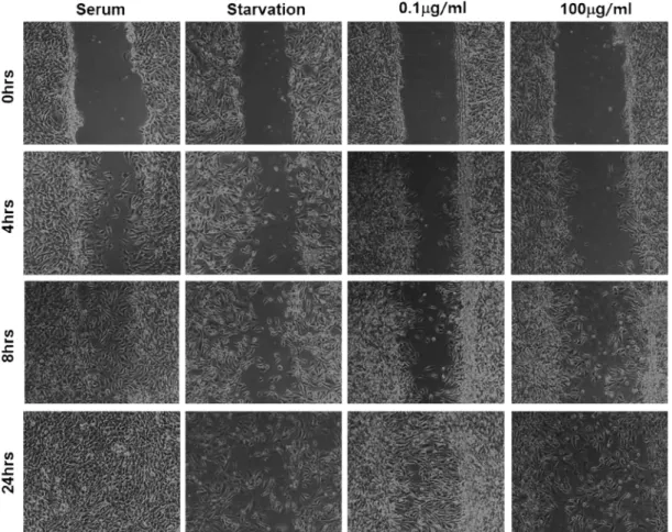 Fig.  3.  PG  at  low  concentration  induces  cell  migration.  Serum-depleted  BAEC  were  scraped  by  a  scraper  after  treated  with  2  mM  thymidine  and  then  treated  with  none,  0.1  μg/ml  PG,  100  μg/ml  PG  or  serum  for  indicated  perio