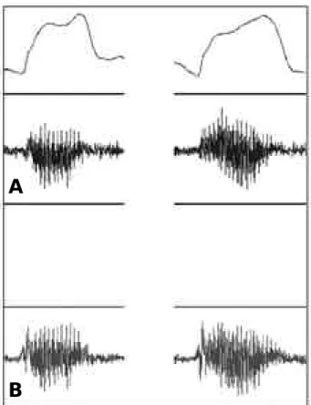 Table 2. Mean Voltages from Dynamic EMG* Before and After EST †