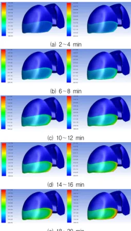 Fig.  4.  Temperature  distribution  at  lung  surface  1