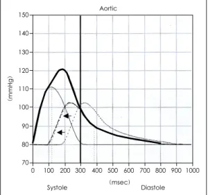 Fig. 1. Pulse wave. The measured pulse pressure wave (             )  must  be  analyzed  as  a  superposition  of  two separate waves: the incident wave (              ) traveling from the heart to periphery, and the reflected wave (            ) travelin
