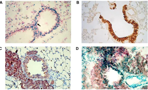 Fig.  2.  Expression  of  SRC-3  and  TTF-1  in  adult  lung  and  lungs  with  CCSP-TAg  induced  cancer  mice