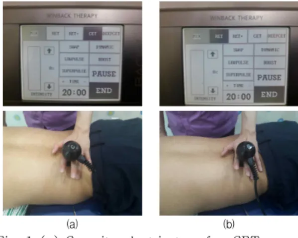 Fig.  1  (a)  Capacity  electric  transfer,  CET. 