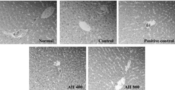 Fig.  4.  Histological  appearances  of  the  liver  tissue  in  type  2  diabetic  of  db/db  mouse  (Hematoxylin  and  eosin,  ×200).