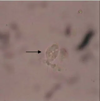 Fig. 1. Wet  mount  examination  of  vaginal  dis- dis-charge  (×200)  shows  a  motile  T