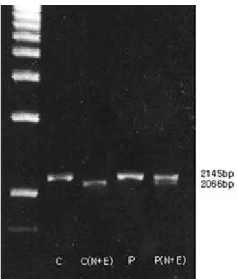 Figure 1.  Restriction analysis of PCR products for the diagno- diagno-sis of HNPP via agarose gel electrophorediagno-sis and ethidium  bro-mide staining